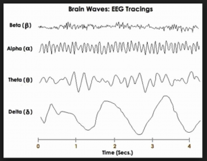 eeg brain scan